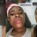 “What did I do to deserve this?” – Lady cries out after her mother’s househelp tried to disfigure her face (video)