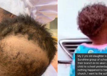 Mom raises alarm after her two-year-old daughter’s hair was allegedly scraped in school with incisions in Ibadan