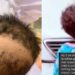 Mom raises alarm after her two-year-old daughter’s hair was allegedly scraped in school with incisions in Ibadan