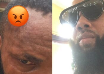 “My APC card couldn’t save me” – Man laments bitterly after Lagos APC thugs brutalized him at his polling unit