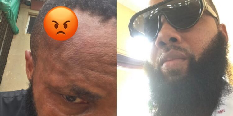 “My APC card couldn’t save me” – Man laments bitterly after Lagos APC thugs brutalized him at his polling unit
