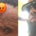 “My APC card couldn’t save me” – Man laments bitterly after Lagos APC thugs brutalized him at his polling unit