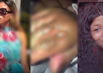 Lady scalds her 2-months-old son’s hand with hot water over a misunderstanding with her baby-daddy in Rivers State