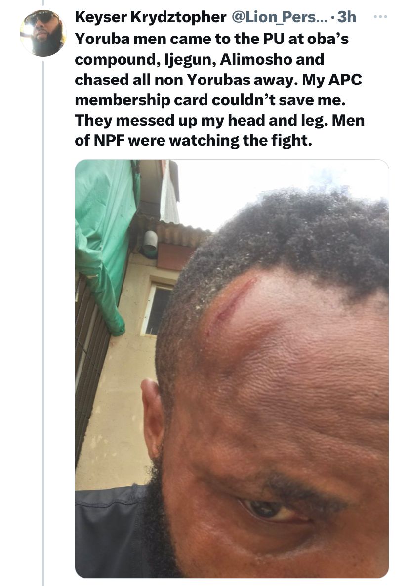 “My APC card couldn’t save me” – Man laments bitterly after Lagos APC thugs brutalized him at his polling unit