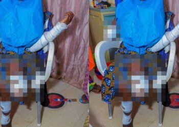 Teen bride loses her  limb after her spouse attacked her with a machete