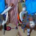 Teen bride loses her limb after her spouse attacked her with a machete