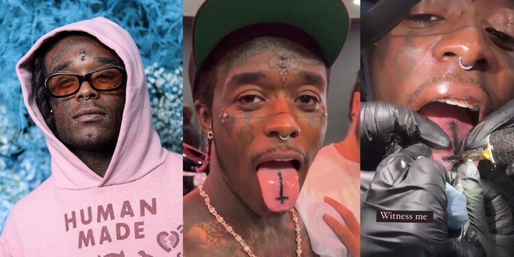 Lil Uzi Vert causes