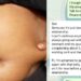 “I feel ashamed to go out with you because of your stomach” – Lady shares heartbreaking message from boyfriend