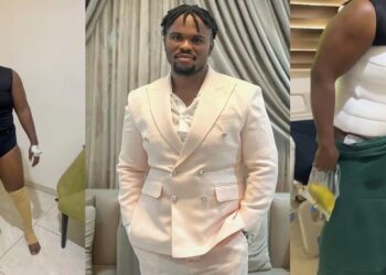 Tosin Silverdam undergoes liposuction surgery, shares recovery journey (Video)