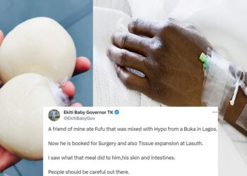 Man gets booked for surgery after consuming fufu fermented with hypo