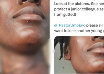 Nigerian doctor seeks urgent help as a junior doctor who was almost k!lled in an attack, allegedly forced back to work the next day by her boss