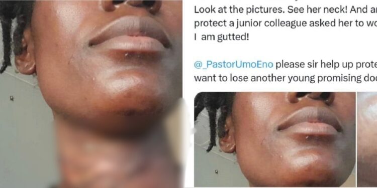 Nigerian doctor seeks urgent help as a junior doctor who was almost k!lled in an attack, allegedly forced back to work the next day by her boss