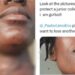 Nigerian doctor seeks urgent help as a junior doctor who was almost k!lled in an attack, allegedly forced back to work the next day by her boss