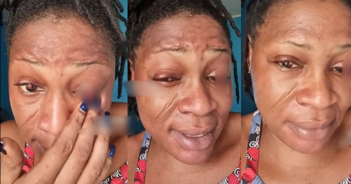 “To get belle come dey fear person” – Netizens React As Woman Shares How Pregnancy Affected Her Eyes (VIDEO)