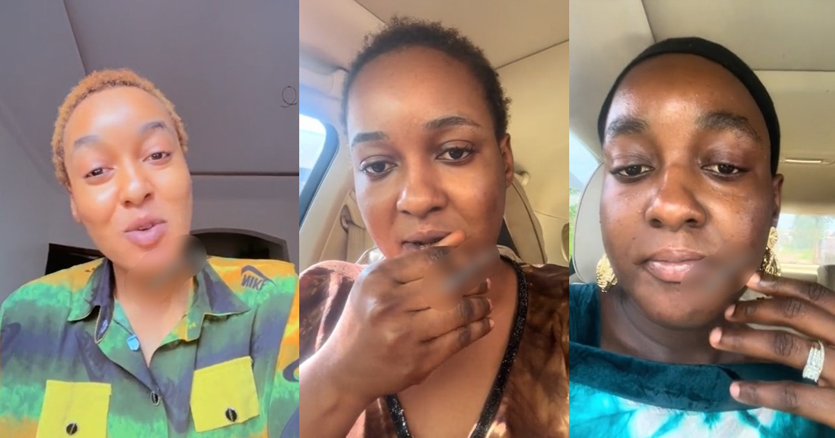 "I stopped bleaching my skin after 7 years" – Nigerian lady shares her