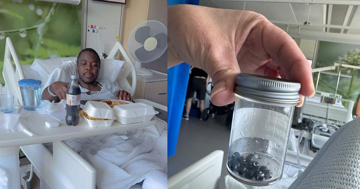 “16 extra bullǝts removed from his body and 3 remaining” – Nigerian political aspirant survives after being sh0t 