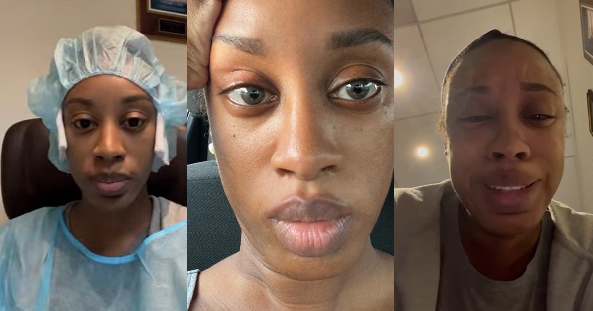 “What happened to contact lens?” – Lady brǝaks down in tǝars after a fa!led eye colour change surgery (VIDEO)