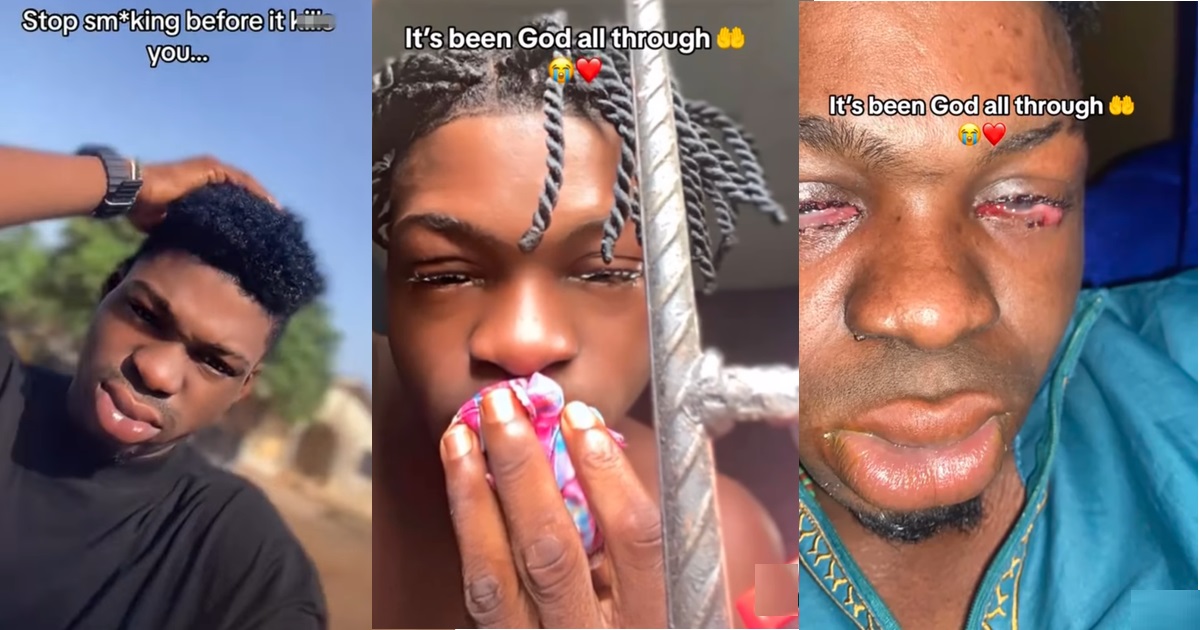 “Stop sm0king before it kpai you” – Man w@rns as he shares ‘eye-catching’ result of what sm0king did to him (VIDEO)