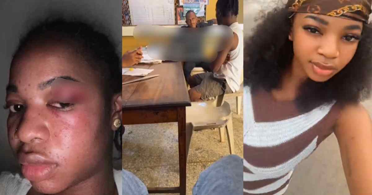 “Them don blow eye witness for eyes” – Lady gets a black eye defending a friend in tox!c relationship (WATCH)