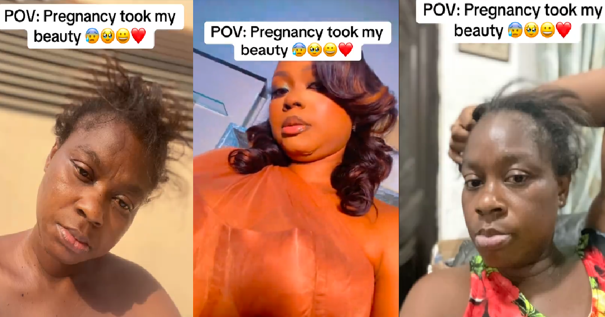 Lady Shares The Drast!c Changes Pregnancy Caused To Her Body (WATCH)