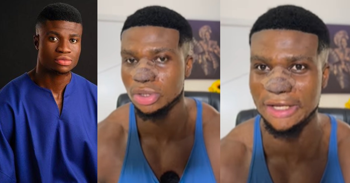 “I love my look and I feel more confident. It will take about a year to see the final result” – Zicsaloma shows off his three-week post-rhinoplasty look (VIDEO)