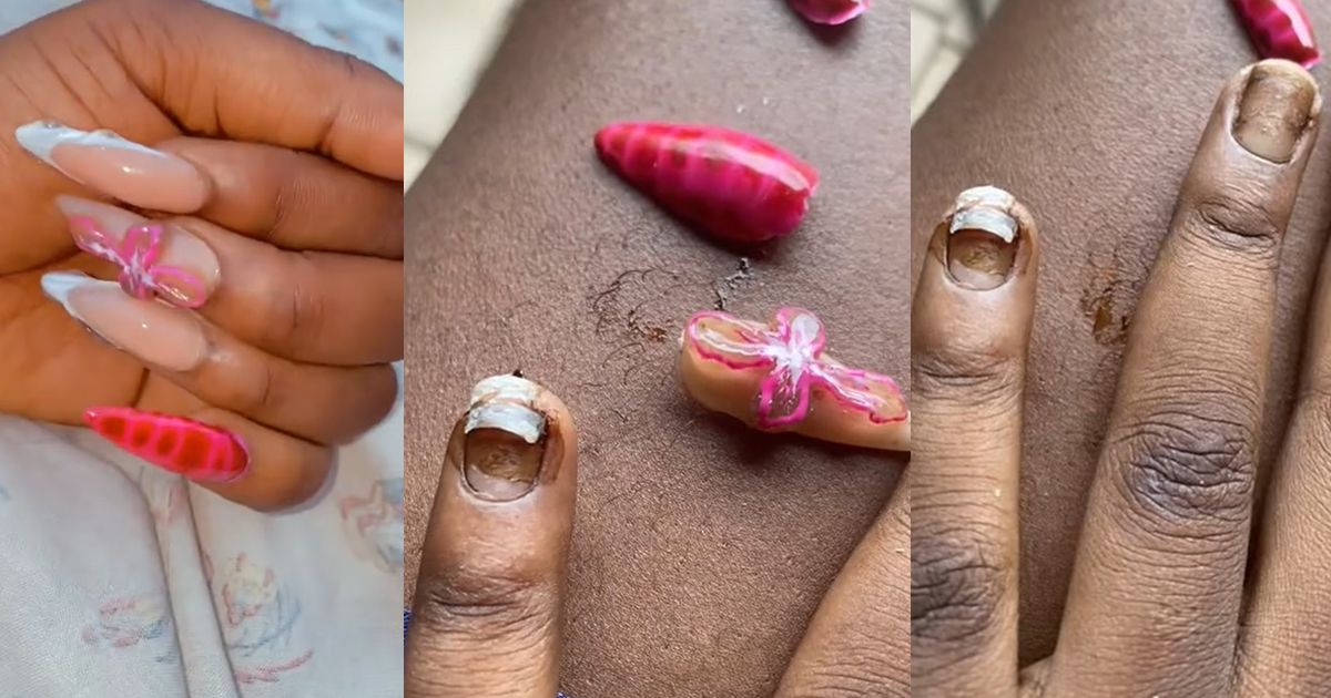 Lady F0rcefully Removes Month-Old Artificial Nails, Claims Nail Tech Used ‘Iron Gum’ (WATCH)