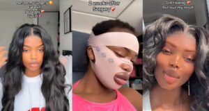 “You are an..insecur3 f00l” – Lady sparks reaction after claiming to have gone through a facial transformation