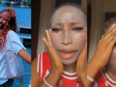 Lady reveals unexpected outcome after applying excess ₦5k sunscreen, leaves her face looking overly white (Watch)