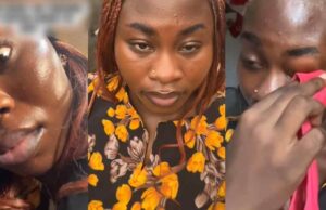 Lady shares how viral sunscreen she was warned about affected her eyes