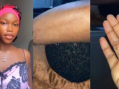 Lady recounts working at a mosquito-infested space after a colleague sleeps through bites (Watch)