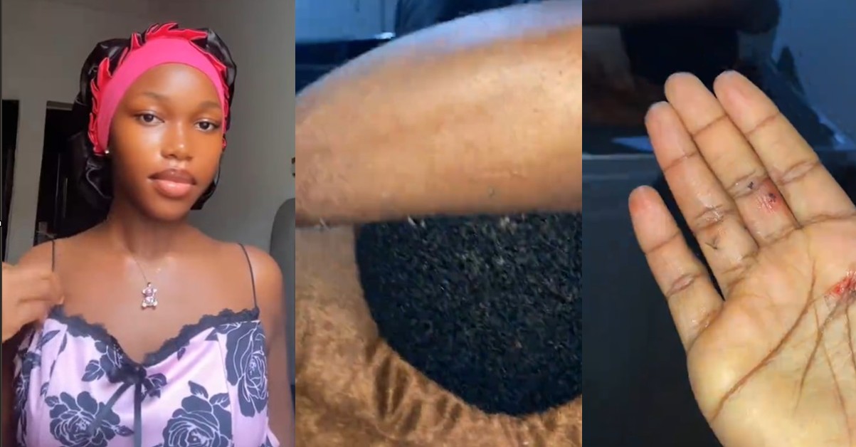 Lady recounts working at a mosquito-infested space after a colleague sleeps through bites (Watch)