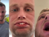 Man who flew to Turkey for teeth surgery now left with no teeth at all