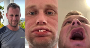 Man who flew to Turkey for teeth surgery now left with no teeth at all
