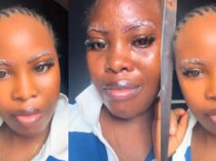 Lady left injurǝd after volunteering as a model for her boss’s first microblading practical session (Watch)