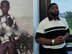 Man turns heads with the remarkable difference between his childhood and adult photos (IMAGES)